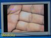 STRYKER ENDOSCOPY Stryker 26" Vision Elect HDTV,Ref 240-030-960 W/ Power Adapter ~ Monitor