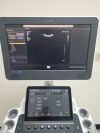 PHILIPS AFFINITI 70G Ultrasound - Cardiac - Vascular