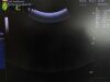 GE 4C-RC Ultrasound Transducer