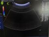 GE 4C-RC Ultrasound Transducer