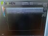 GE 11L-D Ultrasound Transducer