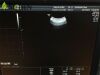 GE RAB4-8-D Ultrasound Transducer