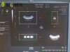 GE RAB2-5-RS Ultrasound Transducer