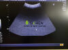 TOSHIBA PVM-375AT Ultrasound Transducer