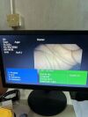 OLYMPUS BF-3C160 Bronchoscope