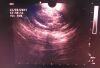 OLYMPUS GF-UCT180 Gastroscope