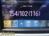 PHILIPS 2013  Intellivue MP5 Patient ,M8105A W/ NBP ECG SpO2 Leads~ Monitor