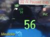 PHILIPS 2013  Intellivue MP5 Ref M8105A Patient Monitor