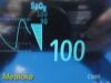 PHILIPS 2013  Intellivue MP5 , Ref M8105A W/ Patient Leads ~ Patient Monitor