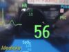 PHILIPS 2013  Intellivue MP5 , Ref M8105A W/ Patient Leads ~ Patient Monitor