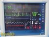 Spacelabs Ultraview SL 94266 Promate 19" Display Monitor