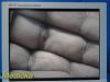STRYKER Ref 240-030-920 19" SV-2 Flat Panel Surg Monitor