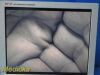 STRYKER Ref 240-030-920 19" SV-2 Flat Panel Surg Monitor