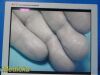 STRYKER Ref 240-030-920 19" SV-2 Flat Panel Surg Monitor