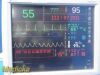 SPACELABS Ultraview SL 94266 Promate 19" LCD Monitor