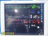 SPACELABS 96266 Promate Electronics Medical Grade LCD Flat Monitor