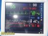 SPACELABS 96266 Promate Electronics Medical Grade LCD Flat Monitor