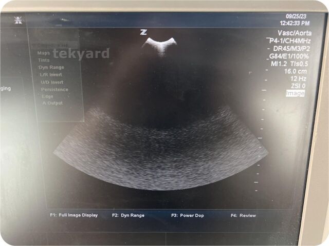 ZONARE P4-1 Probe / Ultrasound Transducer