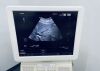 HITACHI Hi-Vision AVIUS Hitachi Hi Vision AVIUS ultrasonic device with 2 probes