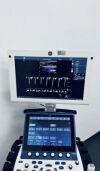 GE VIVID S60 GE VIVID S60 Ultraschallgerät, 9L-D, 3Sc-RS Sonden