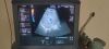 GE Voluson e Ultrasound - OB / GYN - Vascular