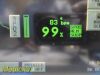 SPACELABS 91496 Command Module Options 1BFMPRV, Masimo SpO2 IBP NBP ECG T