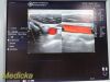 GE 2004  10L Linear Array Ultrasound Transducer