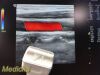 GE 2004  10L Linear Array Ultrasound Transducer