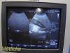 PHILIPS 3D6-2 Volumetric 3D-4D Convex Array Ultrasound Probe *TESTED*/ Ultrasound Transducer