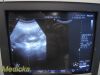 PHILIPS 3D6-2 Volumetric 3D-4D Convex Array Ultrasound Probe *TESTED*/ Ultrasound Transducer