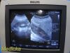 PHILIPS 3D6-2 Volumetric 3D-4D Convex Array Ultrasound Probe *TESTED*/ Ultrasound Transducer