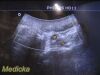 PHILIPS 3D6-2 Volumetric 3D-4D Convex Array Ultrasound Probe *TESTED*/ Ultrasound Transducer