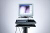 ATMOS Scope Laryngoscope