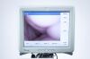 ATMOS Scope Laryngoscope