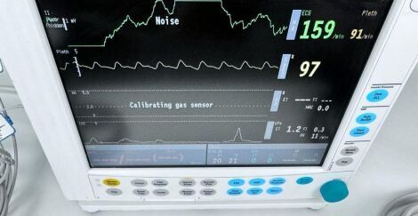 DATEX-OHMEDA S5 Anesthesia Monitor