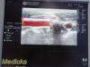 GE HEALTHCARE 2014 GE 7L Linear Array Ultrasound Transducer