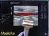 GE HEALTHCARE 2014 GE 7L Linear Array Ultrasound Transducer