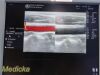 GE HEALTHCARE 2014 GE 7L Linear Array Ultrasound Transducer