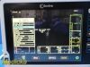 INVIVO 2011 Philips  Model 865214 Expression MRI Monitor