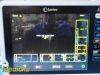 INVIVO 2011 Philips  Model 865214 Expression MRI Monitor