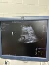 GE Logiq E9 Ultrasound - OB / GYN - Vascular