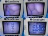 VERATHON 0570-0304 Glidescope Cobalt AVL Monitor
