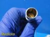 Resonant Medical Ultrasonix C5-2/40 Convex