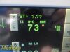 SPACELABS 91369 Ultraview SL Touch, W/ PSU, Module & NEW Leads ~ Monitor