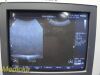 PHILIPS C5-2 Model 21426A Convex Array Ultrasound Transducer