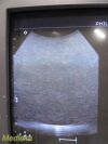 PHILIPS C5-2 Model 21426A Convex Array Ultrasound Transducer