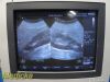 PHILIPS C5-2 Model 21426A Convex Array Ultrasound Transducer