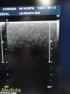 PHILIPS L8-4 Linear Array Ultrasound Transducer