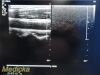PHILIPS L8-4 Linear Array Ultrasound Transducer