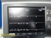 GE HEALTHCARE GE Mac 5500 ECG Machine W/ CAM-14 Module,